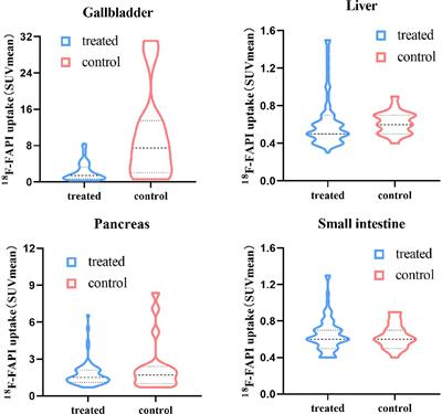 Impact of fat intake on [18F]AlF-NOTA-FAPI-04 uptake in normal abdominal organs